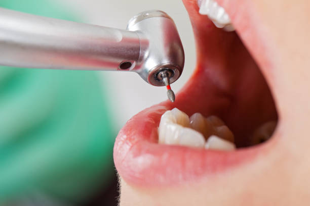 Best Pediatric Emergency Dentist in Portageville, MO